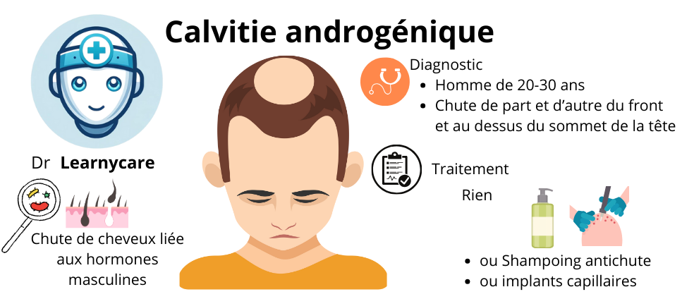 Calvitie androgénique infographie