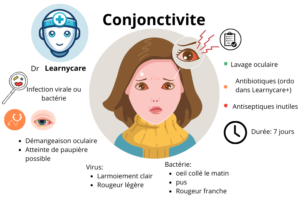 Conjonctivite infographie