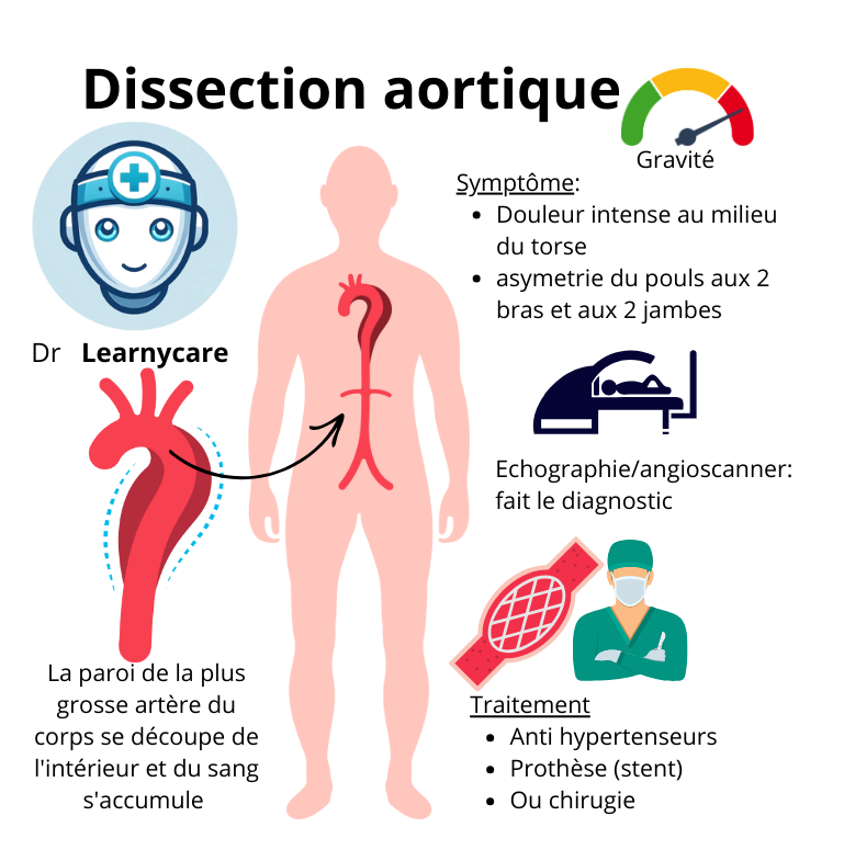 Dissection aortique infographie Dr Learnycare