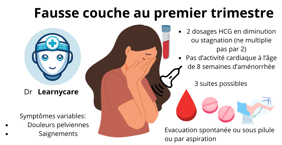 Fausse couche infographie