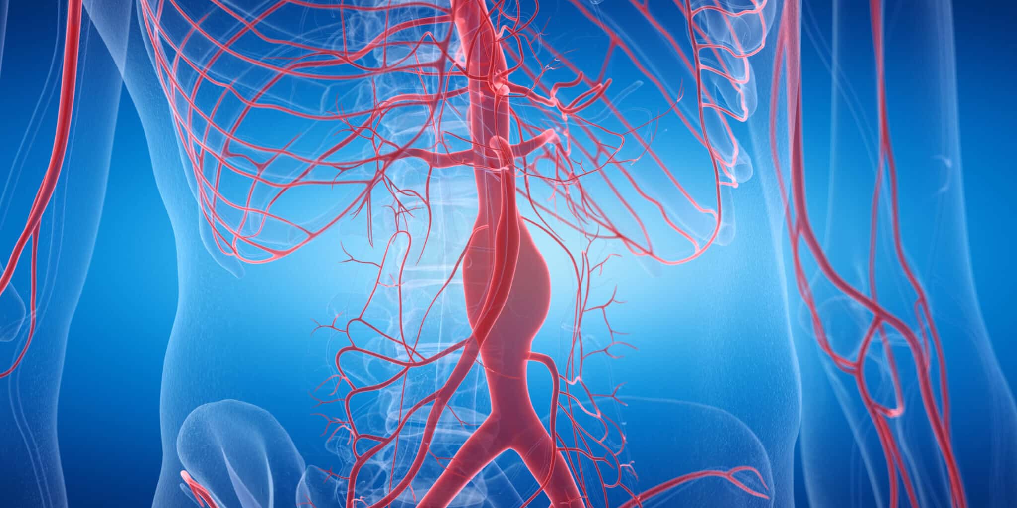 Rupture de l’isthme de l’aorte