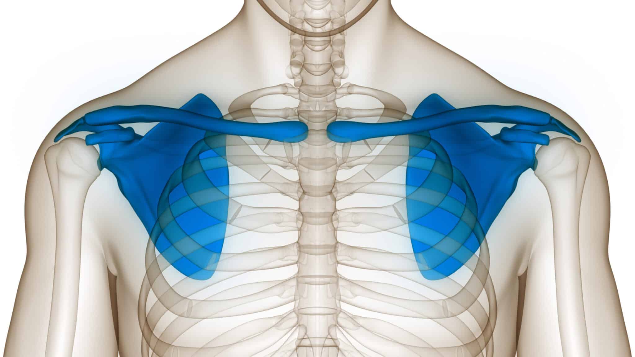 Fracture de l’omoplate