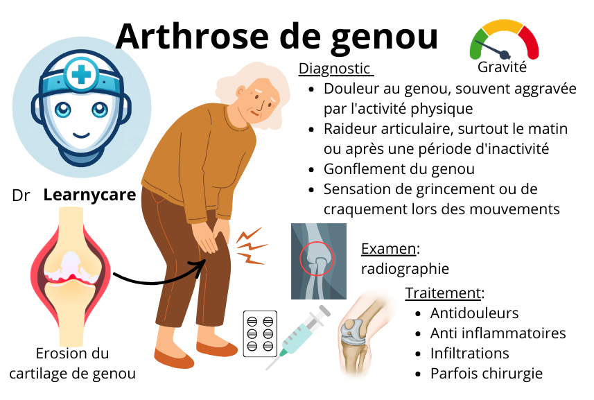 Arthrose de genou infographie Dr Learnycare