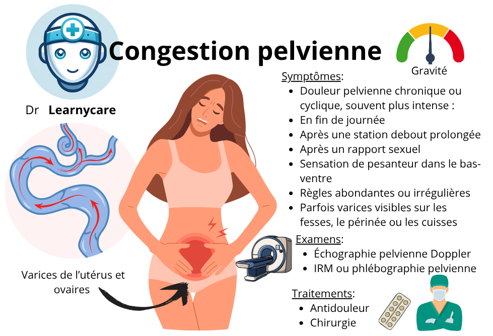 Congestion pelvienne infographie Dr Learnycare