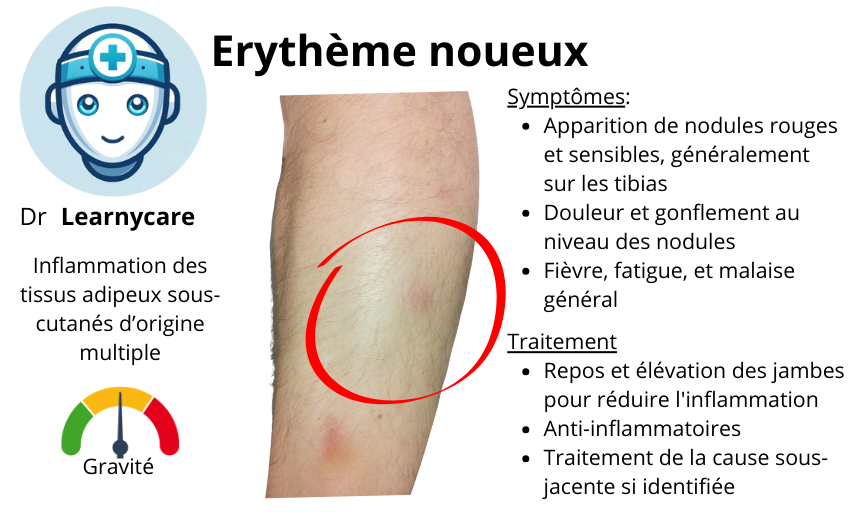 Erythème noueux infographie Dr Learnycare