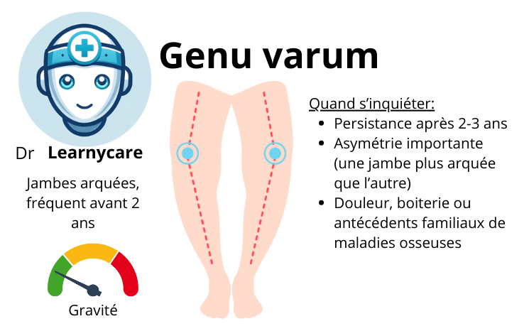 Genu varum infographie Dr Learnycare