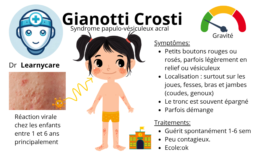 Syndrome de Gianotti Crosti infographie Dr Learnycare