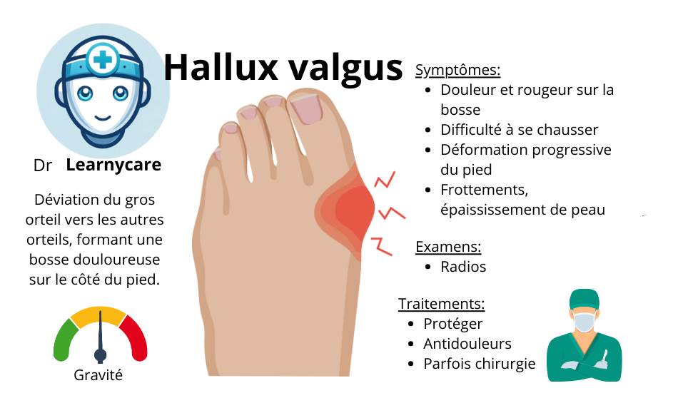 Hallux valgus infographie Dr Learnycare