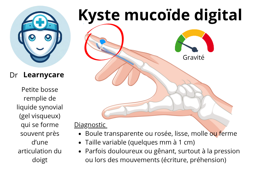 Kyste mucoïde digital infographie Dr Learnycare