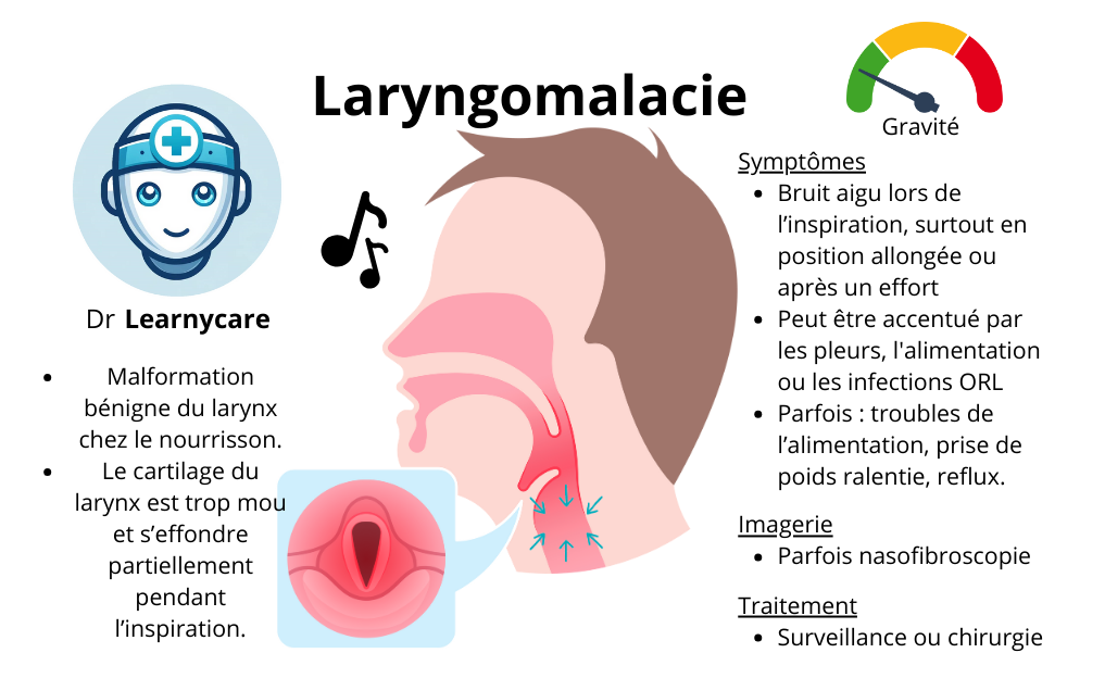 Laryngomalacie infographie Dr Learnycare
