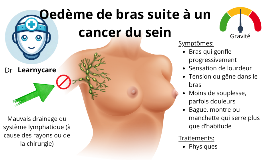 Lymphoedème de bras après cancer de sein infographie Dr Learnycare