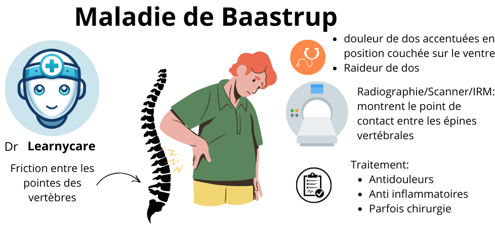 Maladie de Baastrup infographie