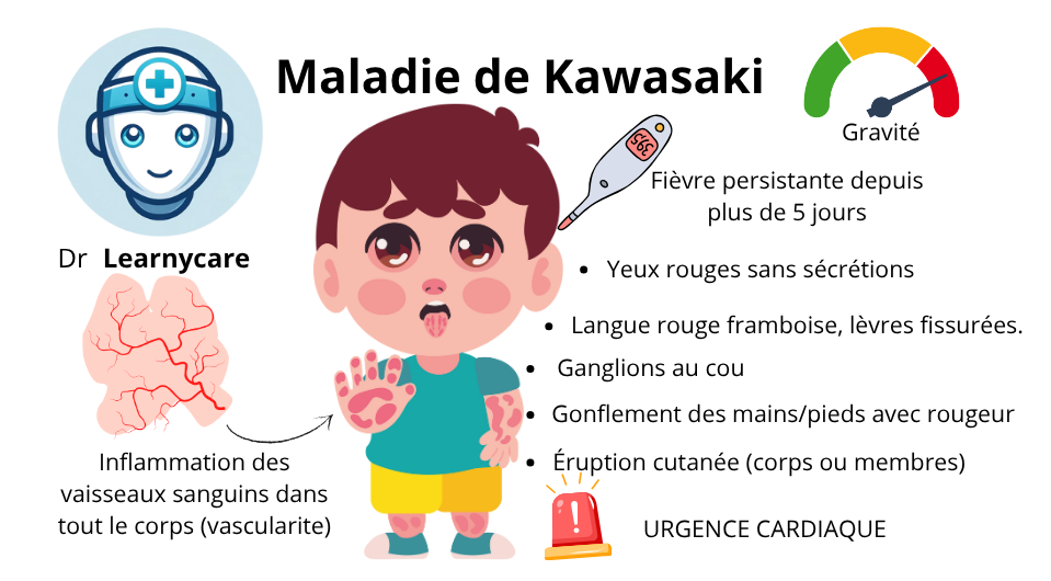 Maladie de Kawasaki infographie Dr Larnycare