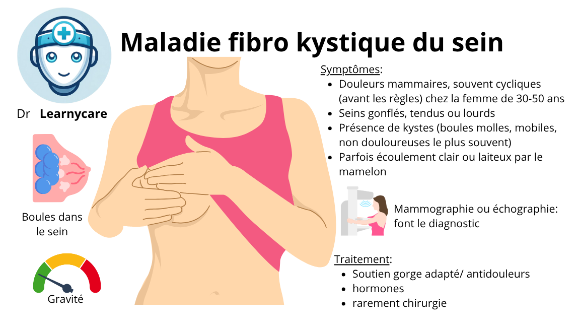 Maladie fibro kystique du sein infographie Dr Learnycare