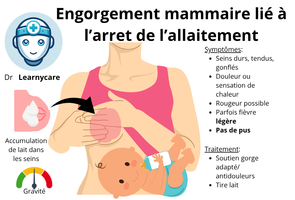 Engorgement mammaire lié à l'arrêt de l'allaitement infographie Dr Learnycare