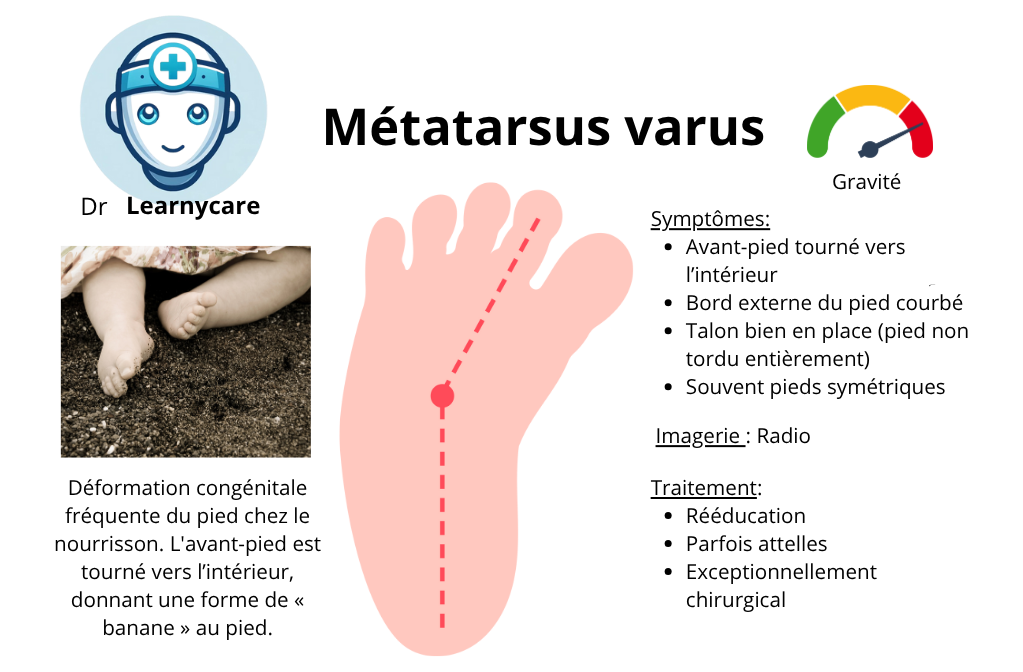 Métatarsus varus infographie Dr Learnycare