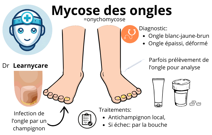 Mycose des ongles infographie Dr Learnycare