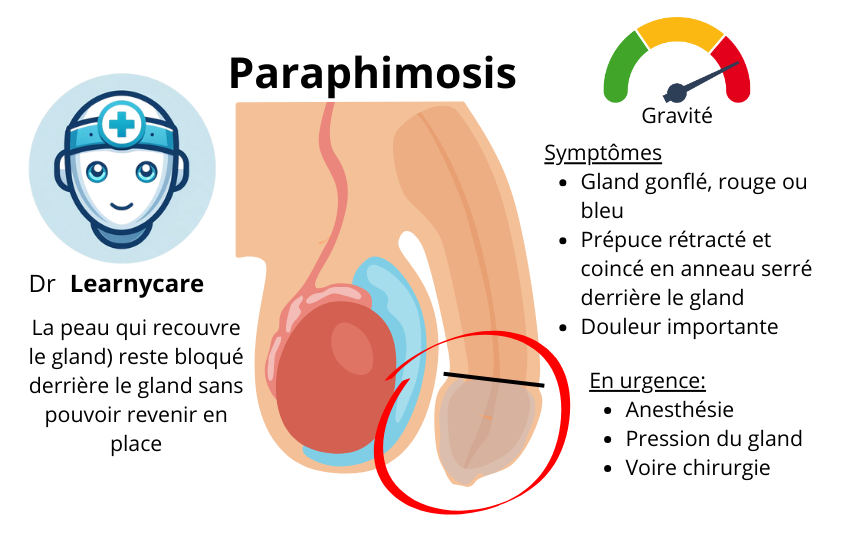 Paraphimosis infographie Dr Learnycare