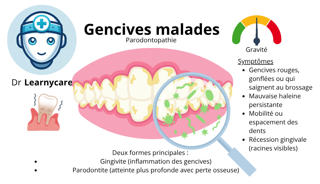 Gencives malades (gengivite, parodontite) infographie Dr Learnycare