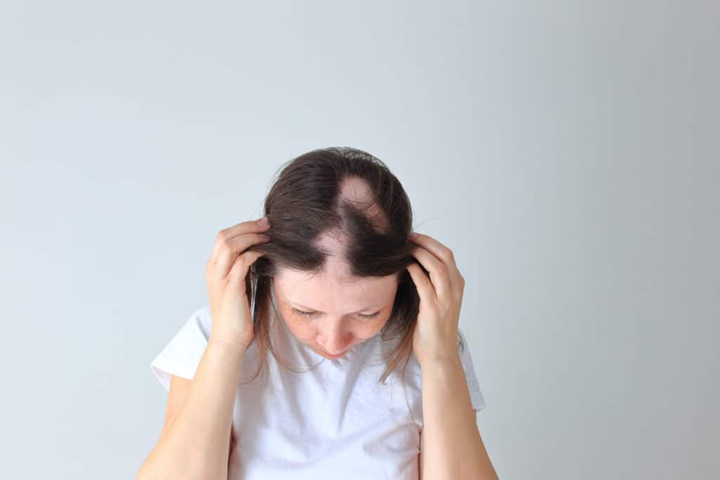 Prurigo strophulus - Dr Learnycare