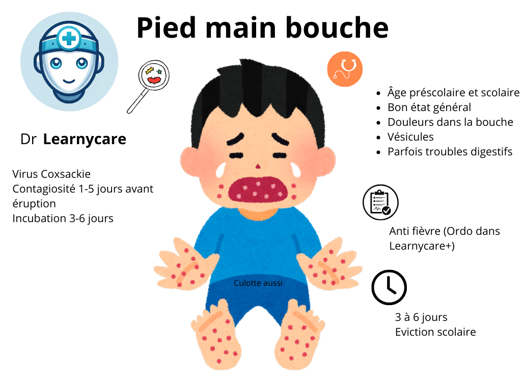 Infographie Pied main bouche