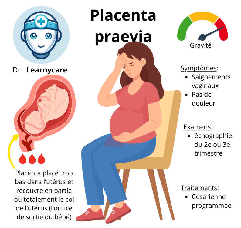 Placenta praevia (recouvrant) infographie Dr Learnycare