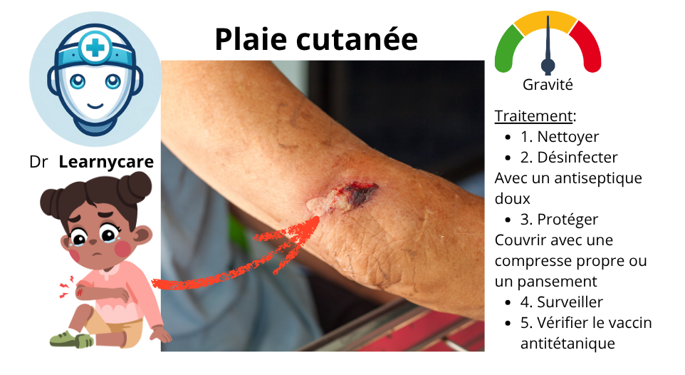 Plaie cutanée infographie Dr Learnycare