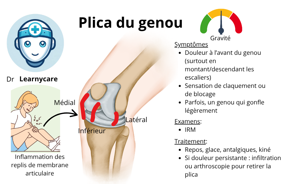 Plica du genou infographie Dr Learnycare