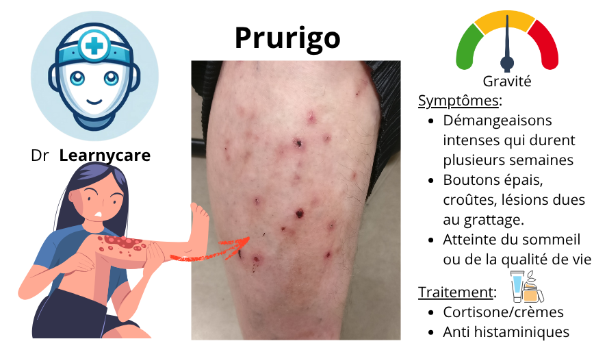 Prurigo infographie Dr Learnycare