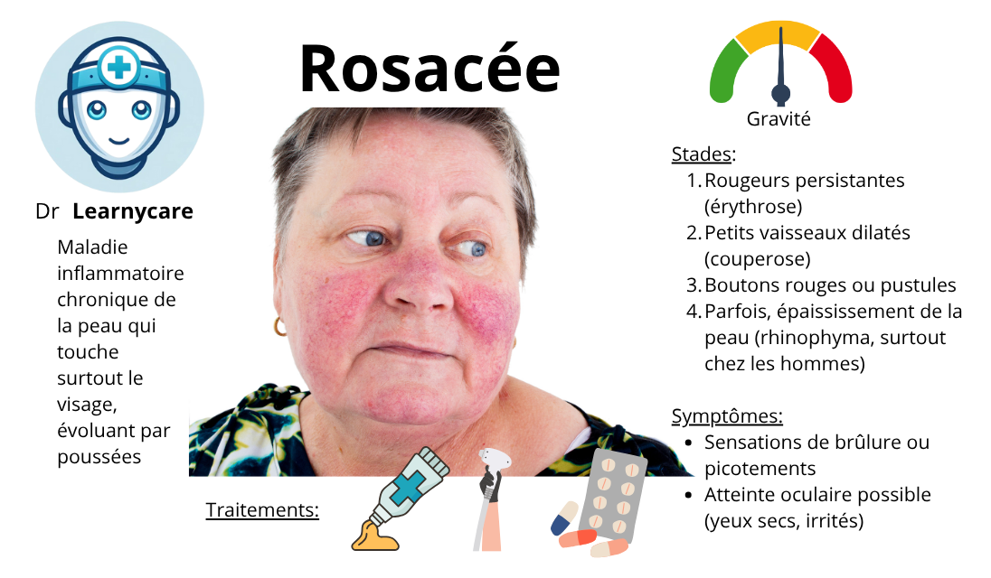 Rosacée infographie Dr Learnycare