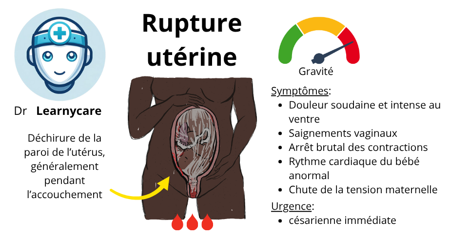 Rupture utérine infographie Dr Learnycare