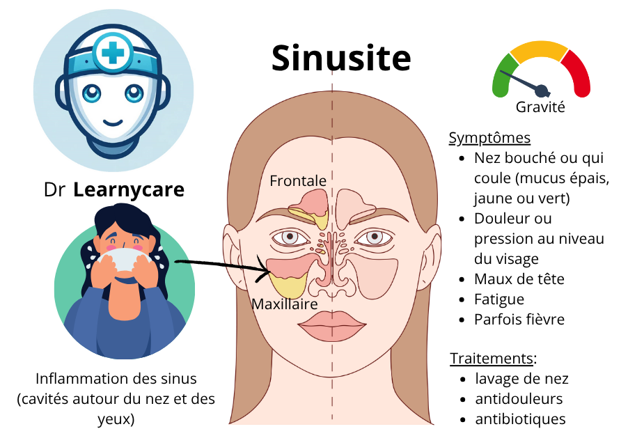 Sinusite infographie Dr Learnycare