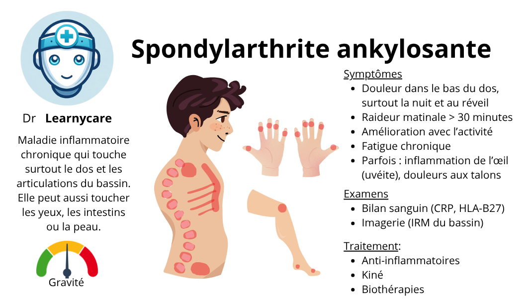 Spondylarthrite ankylosante infographie Dr Learnycare