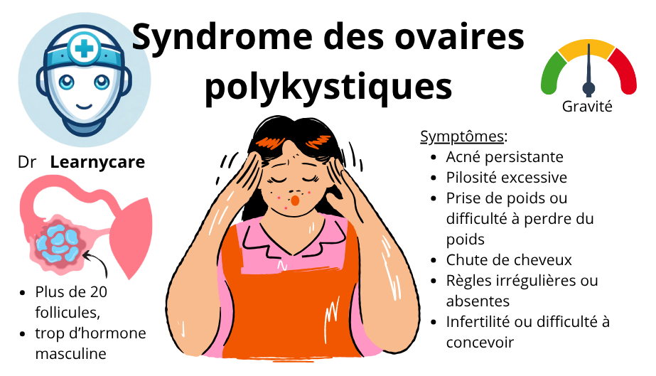 Syndrome des ovaires polykystiques infographie Dr Learnycare