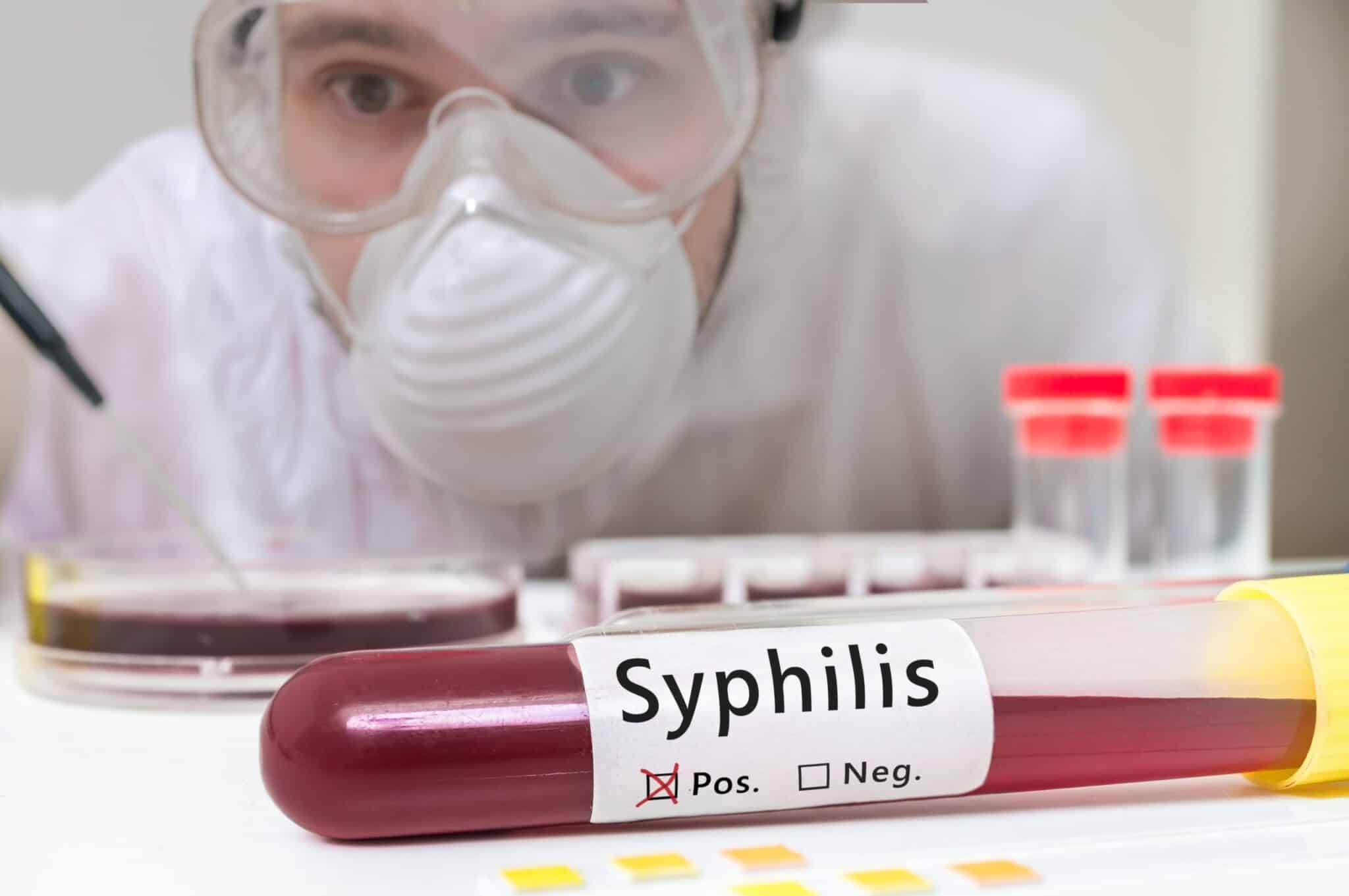 Syphilis