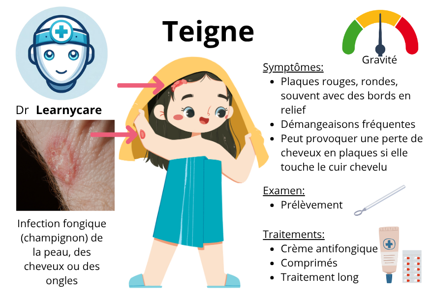 Teigne infographie Dr Learnycare