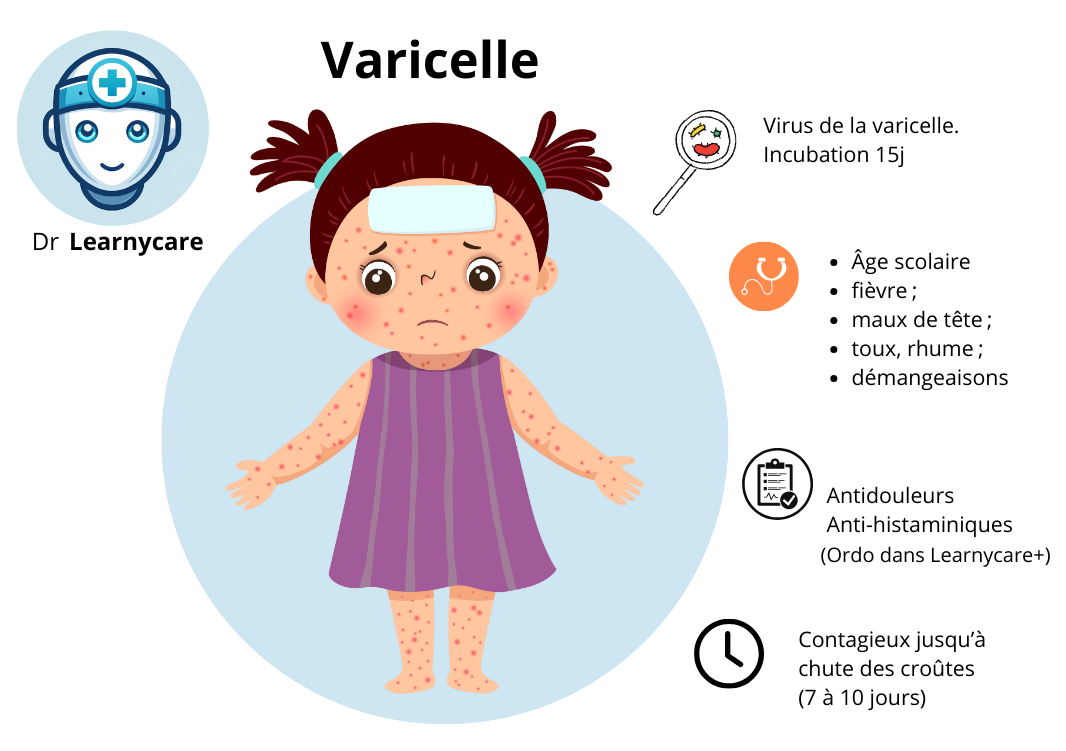 Infographie varicelle