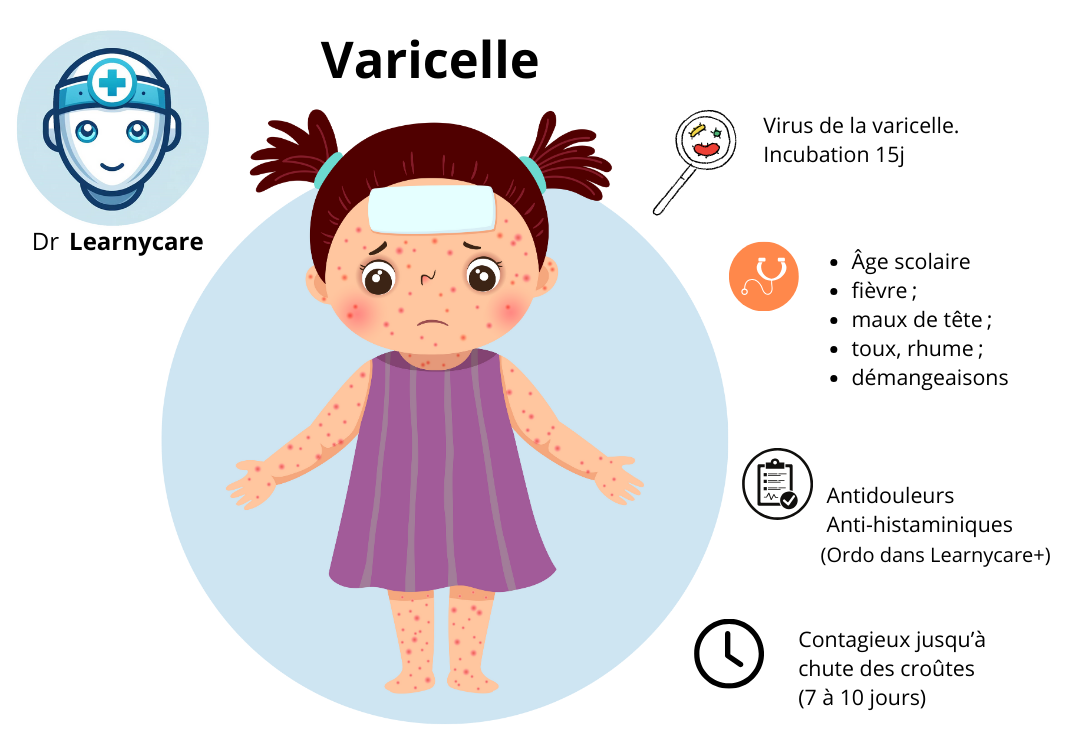Varicelle Sympt mes Dur e Contagion Traitement Et Quand S 