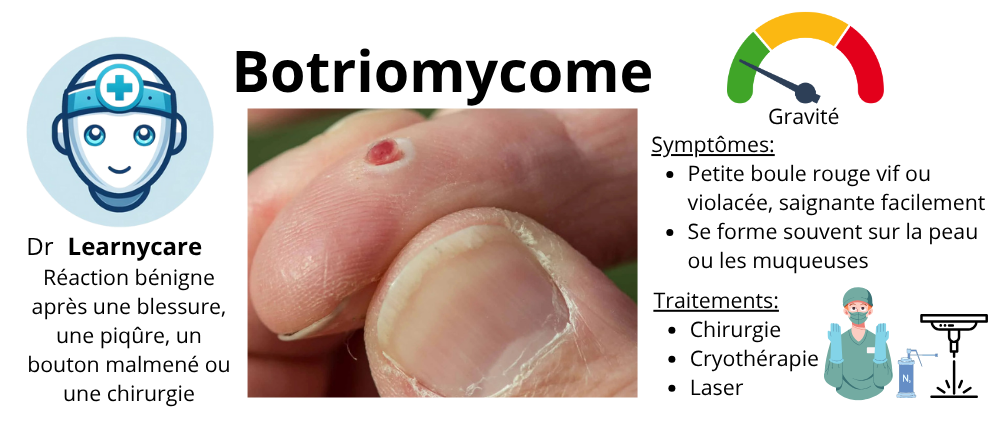 Botriomycome infographie Dr Learnycare