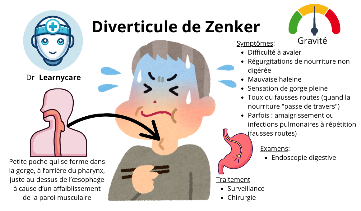 Diverticule de Zenker infographie Dr Learnycare