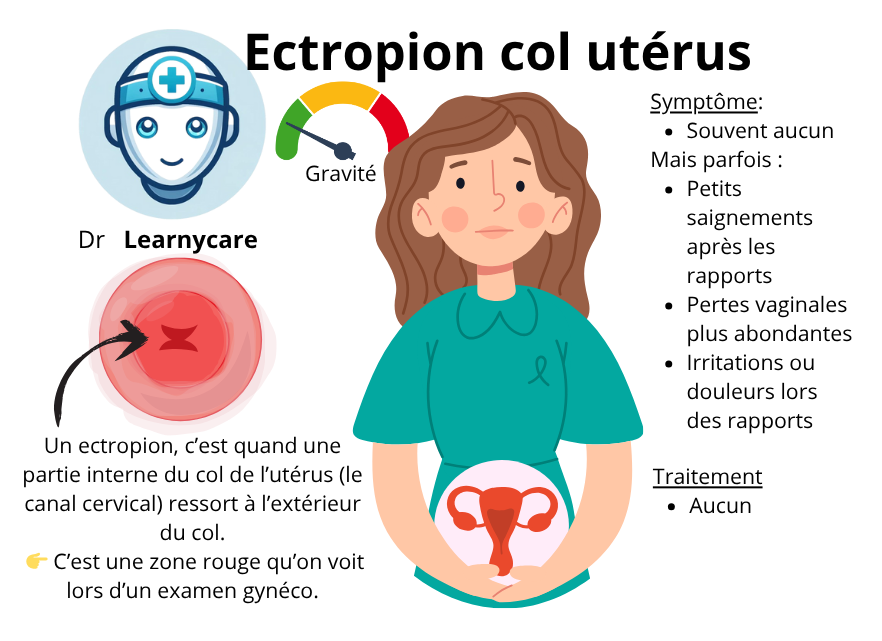 Ectropion col utérus infographie Dr Learnycare