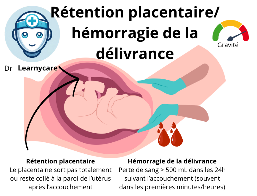 Rétention placentaire ou hémorragie de la délivrance infographie Dr Learnycare