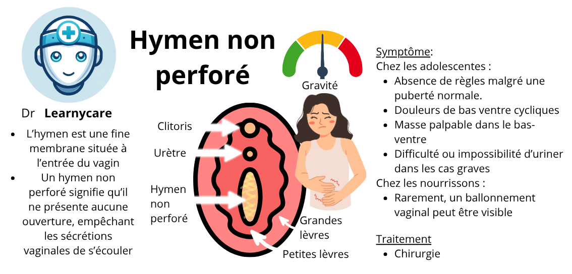 Hymen non perforé infographie Dr Learnycare