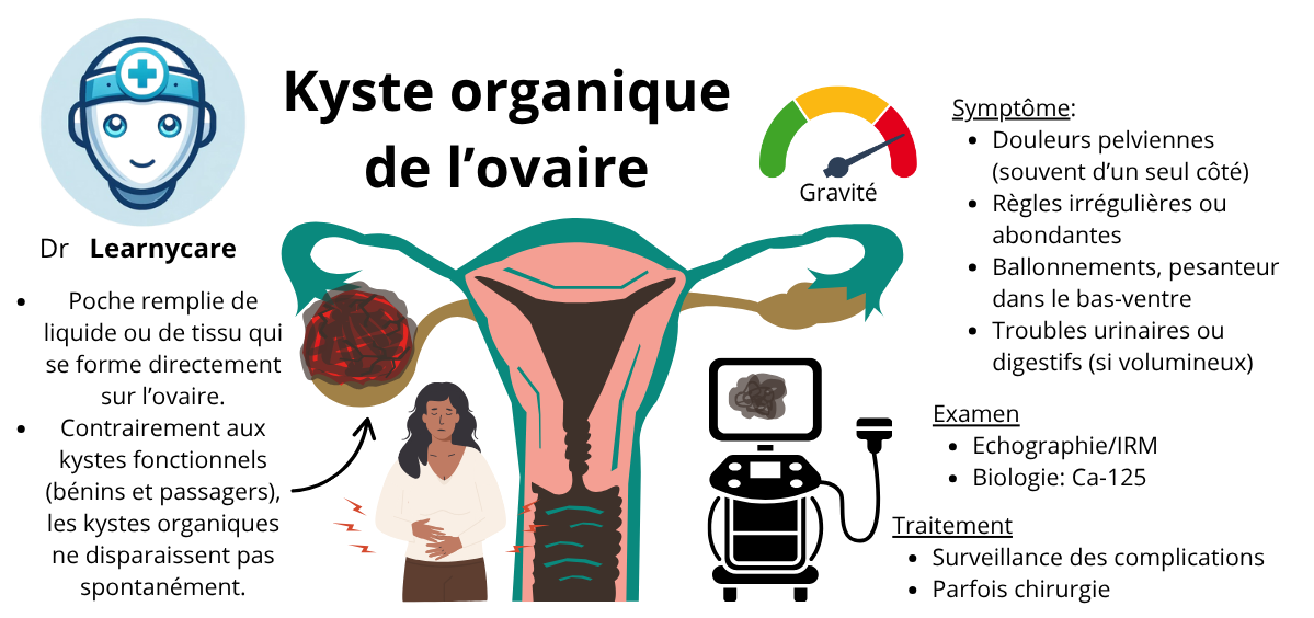 Kyste organique de l'ovaire Dr Learnycare