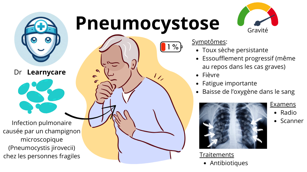 Pneumocystose infographie Dr Learnycare