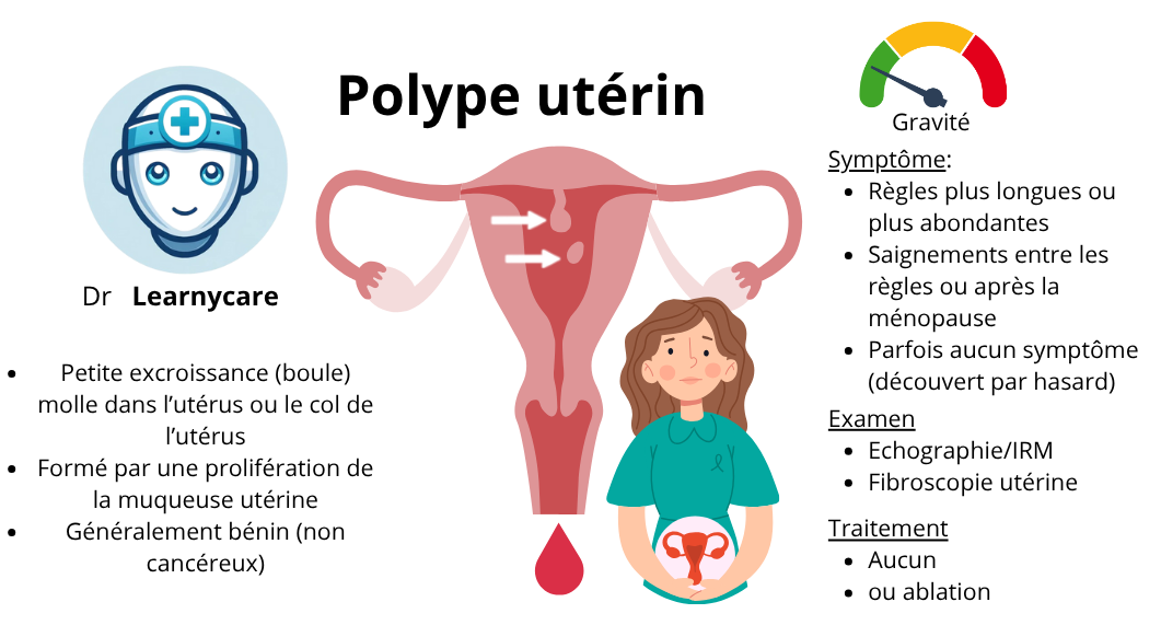 Polype utérin infographie Dr Learnycare