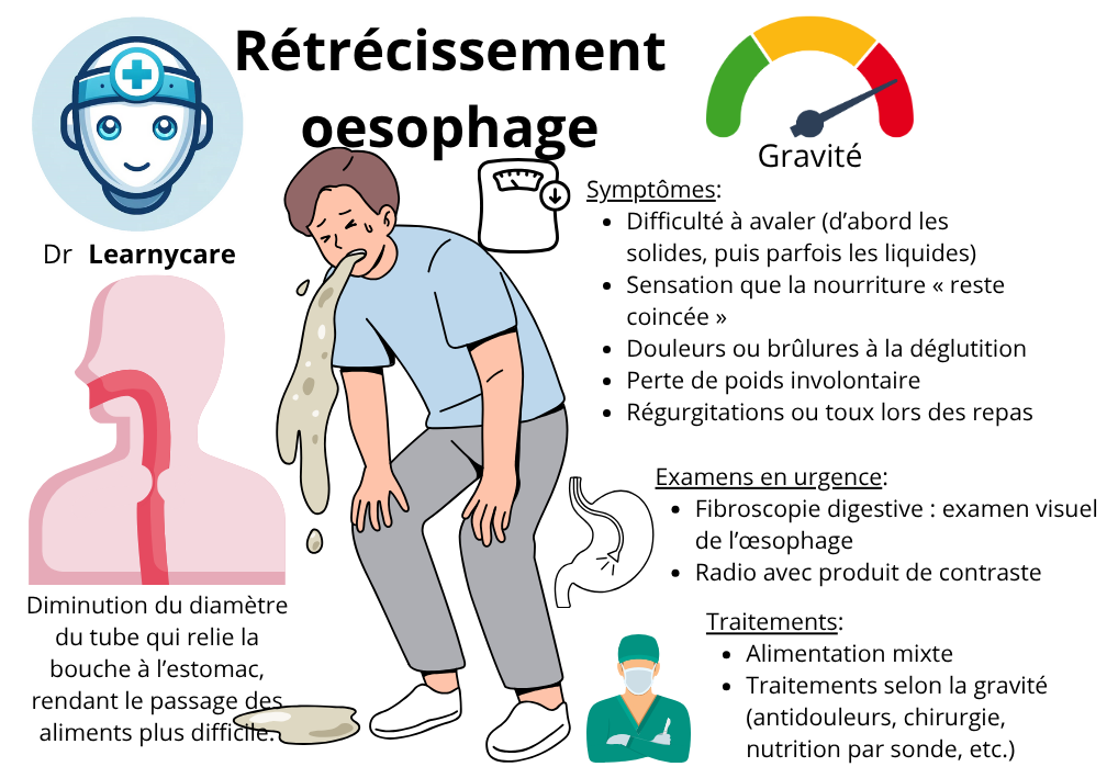 Rétrécissement de l'oesophage infographie Dr Learnycare