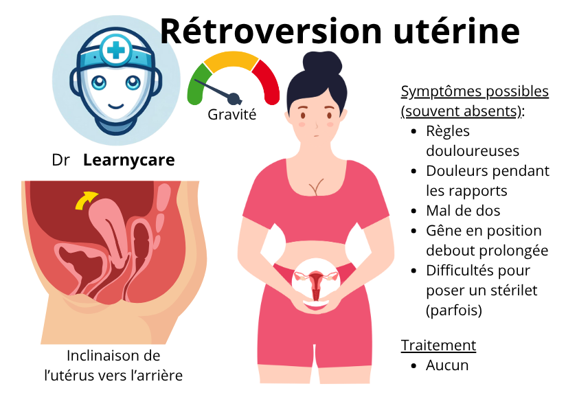 Rétroversion utérine infographie Dr Learnycare