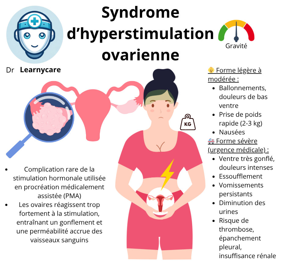 Syndrome d'hyperstimulation ovarienne infographie Dr Learnycare