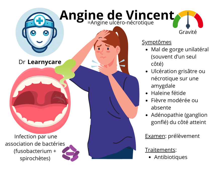 Angine de Vincent infographie Dr Learnycare
